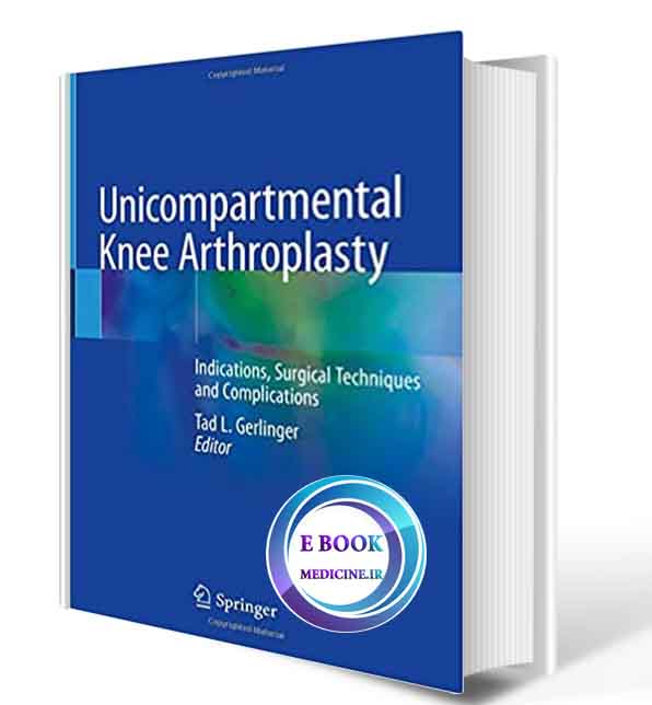 دانلود کتاب Unicompartmental Knee Arthroplasty: Indications, Surgical Techniques and Complications 1st ed. 2020 (ORIGINAL PDF)